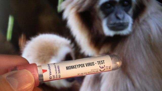 整理包/猴痘恐成為下一個大魔王?猴痘症狀、傳染途徑、預防方式一篇看仔細!